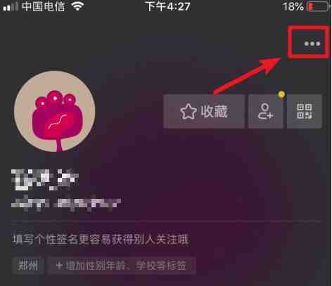 抖音商品橱窗怎么开通？抖音商品橱窗需要什么条件